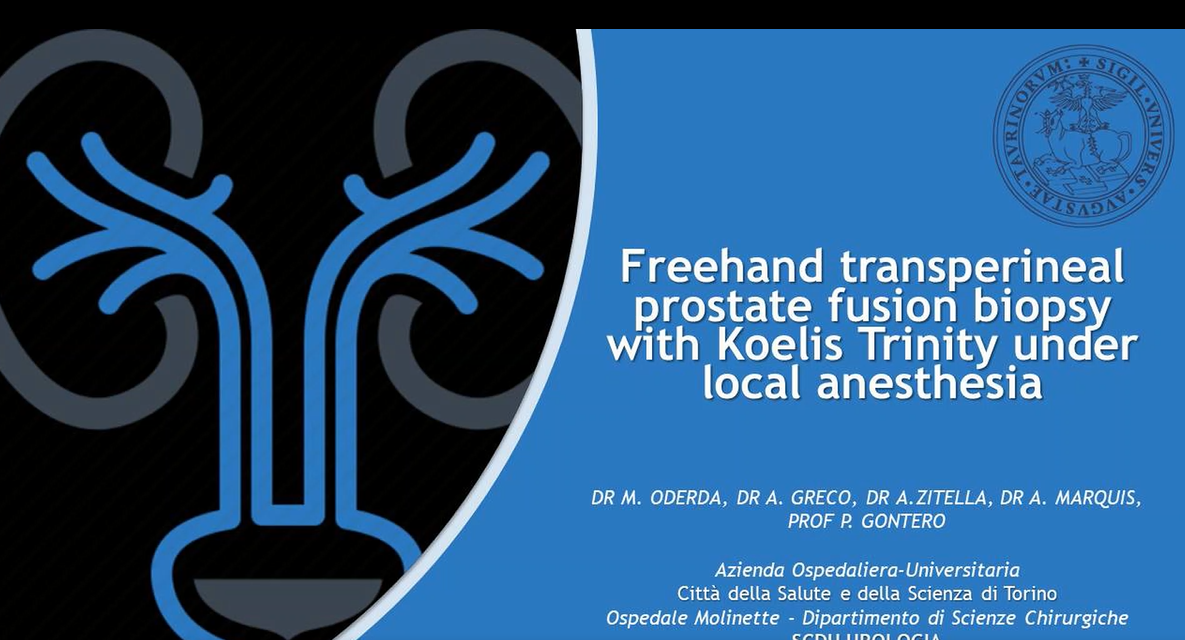 Freehand transperineal prostate fusion biopsy with KOELIS Trinity under local anesthesia – Dr. Oderda