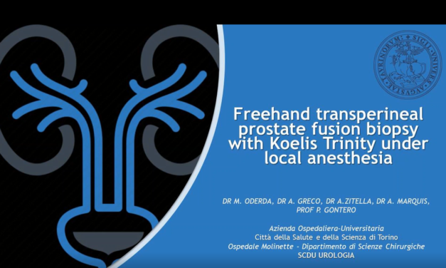 Freehand transperineal prostate fusion biopsy with KOELIS Trinity under local anesthesia – Dr. Oderda