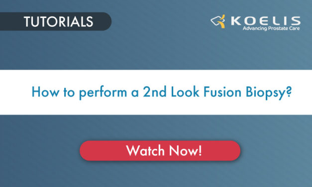 How to perform a 2nd Look Fusion biopsy?