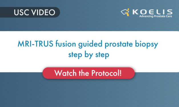 MRI-TRUS fusion guided prostate biopsy step by step