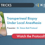 Transperineal Biopsy Under Local Anesthesia – Dr. Simon Bott Protocol