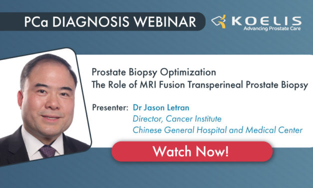 Prostate Biopsy Optimization: The role of MRI fusion Transperineal Prostate Biospy