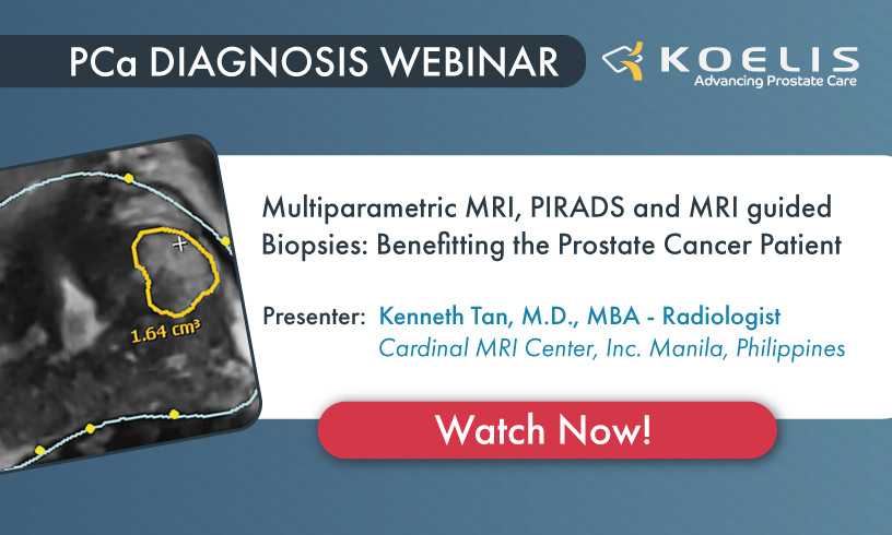 Multiparametric MRI, PIRADS and MRI guided Biopsies: Benefitting the Prostate Cancer Patient