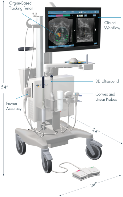 prostate ultrasound equipment