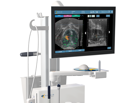 3D MRI/ultrasound fusion biopsy system