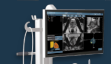 Koelis Announces New Product Release at AUA 2024 to Offer Innovative AI-Enhanced MRI Fusion Biopsy Workflow