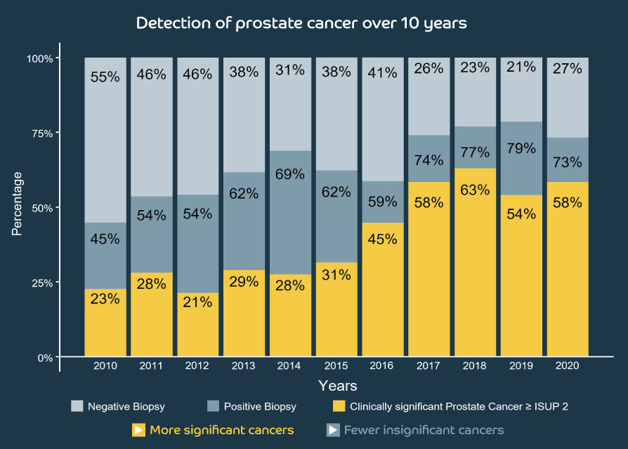 prostate cancer mri detection chart