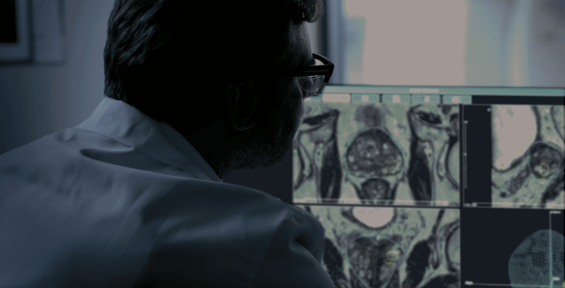 Radiologist looking at prostate biopsy.