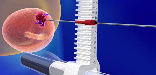 Focal prostate cancer ablation with MRI-ultrasound fusion