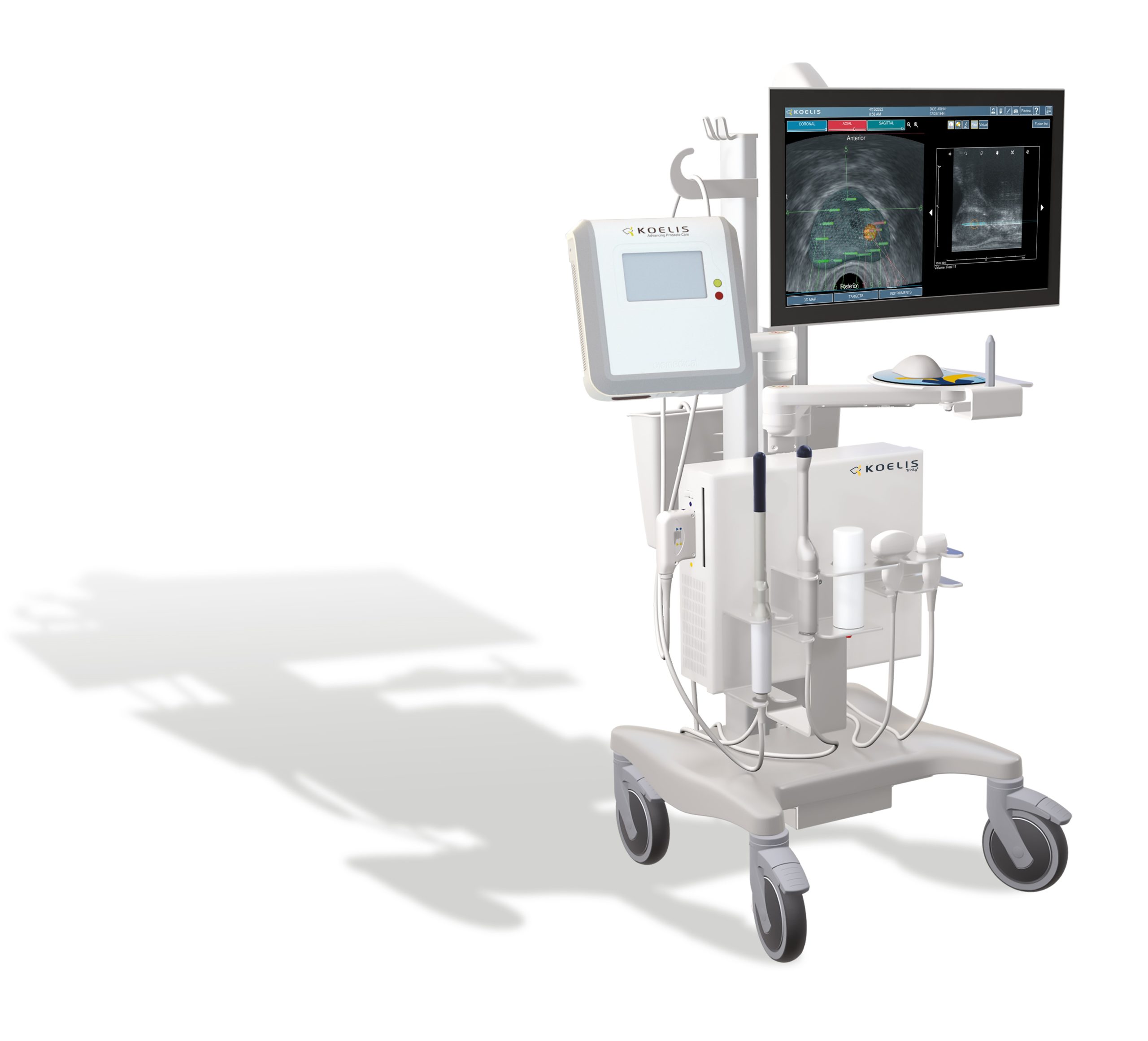 KOELIS ProMap Smart contouring on KOELIS Trinity