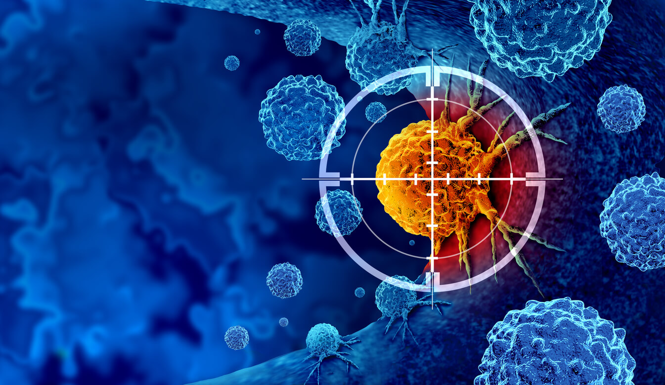 hifu cancer cells