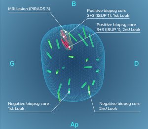 post biopsy review