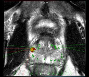 Post-Biopsy Review