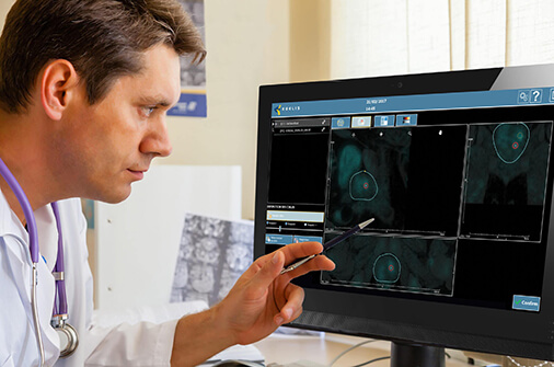 prostate biopsy workflow